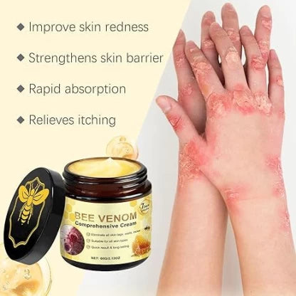Bee venom cream