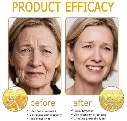 Bee venom cream